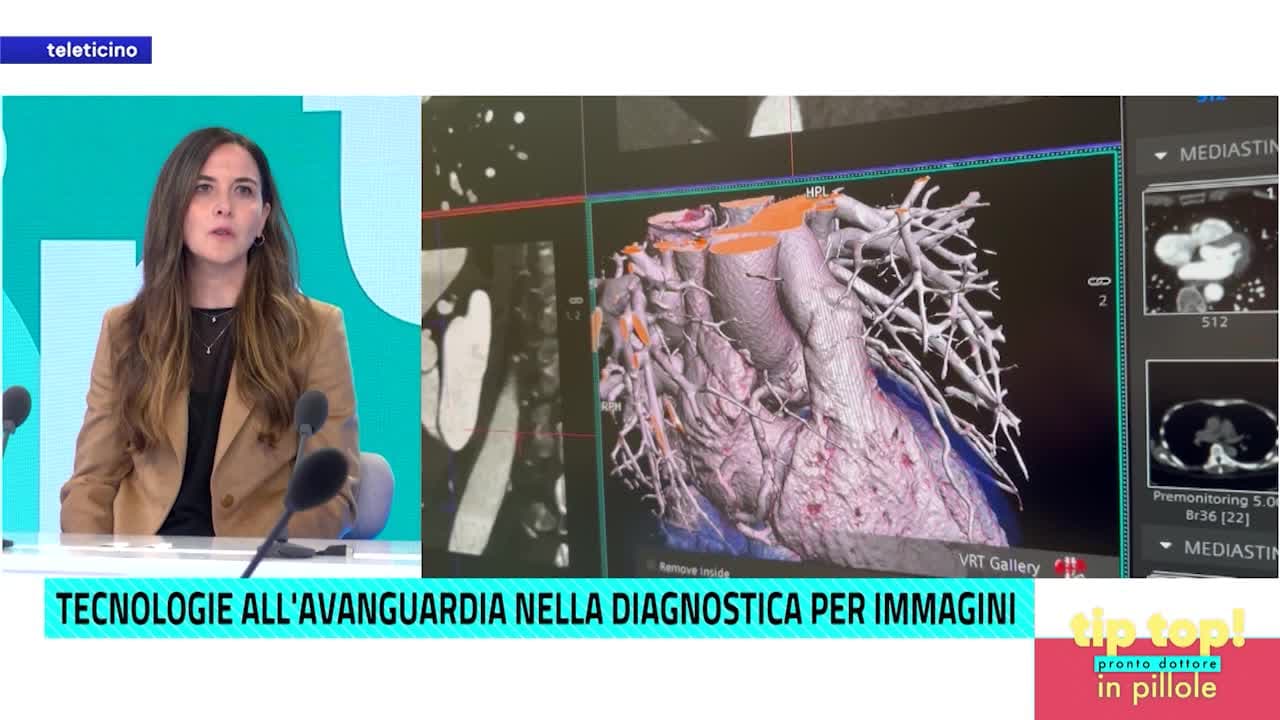 Tip Top Pronto Dottore in Pillole del 26 novembre - TECNOLOGIE ALL'AVANGUARDIA NELLA DIAGNOSTICA PER IMMAGINI