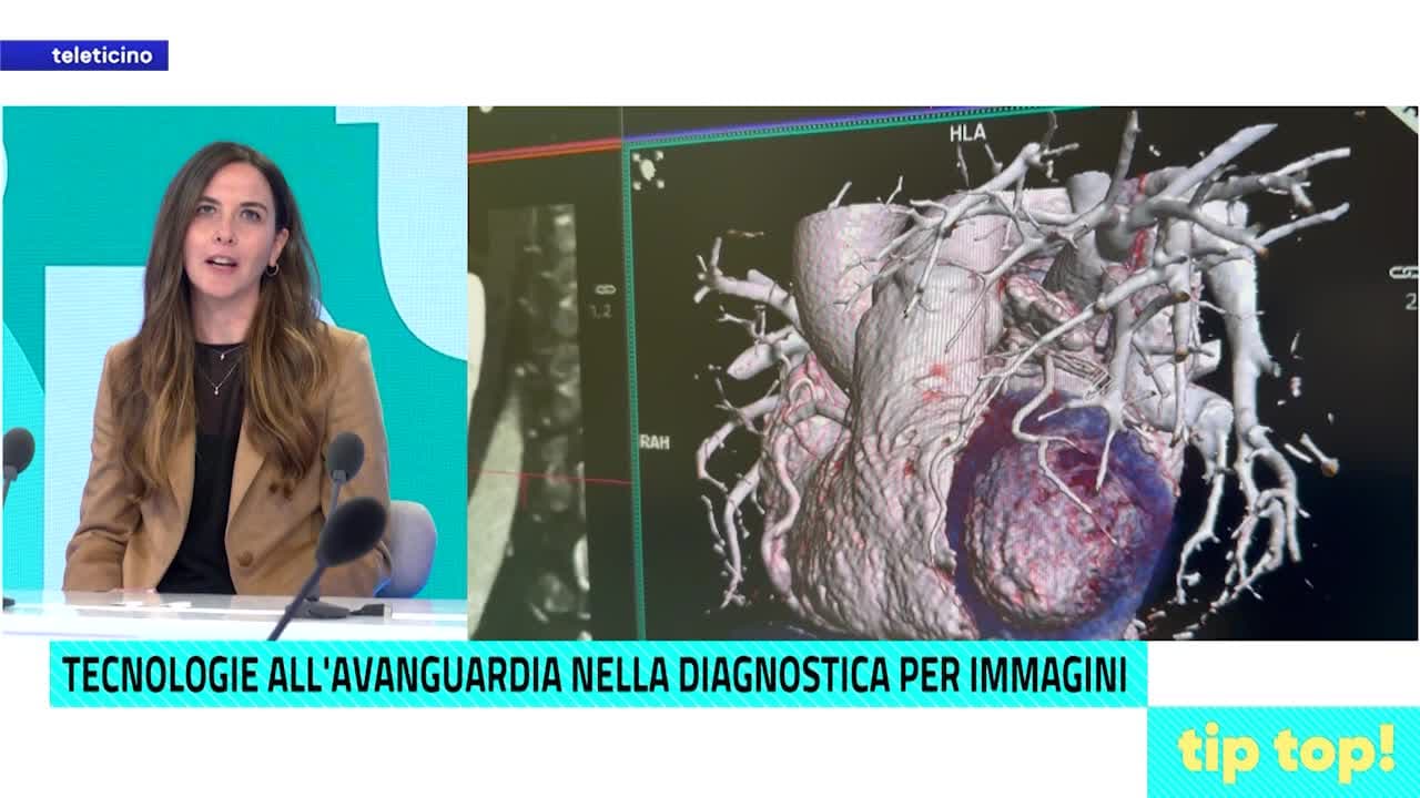 TIP TOP Pronto Dottore del 25 novembre 2025 - TECNOLOGIA ALL'AVANGUARDIA NELLA DIAGNOSTICA PER IMMAGINI